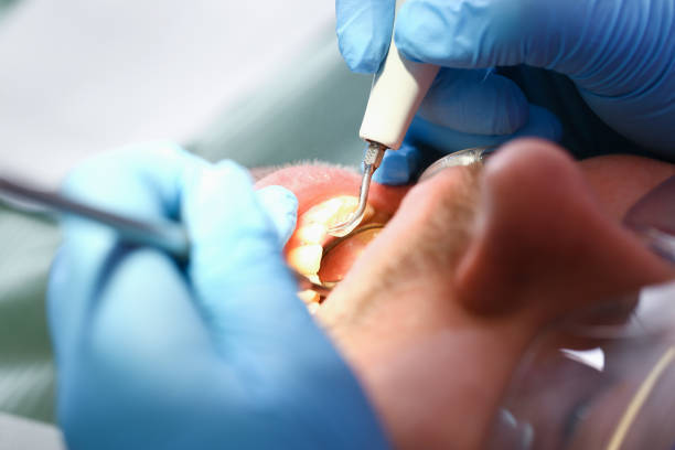 Best Broken or Chipped Tooth Repair in Discovery Harbour, HI